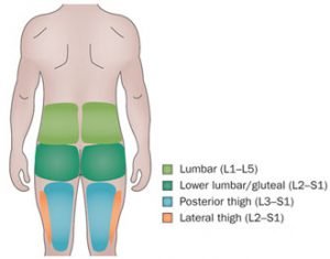 Lumbar