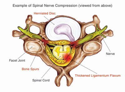 spinal nerve