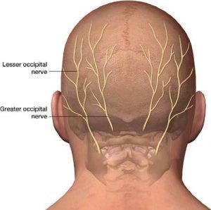 Occipital Neuralgia