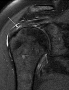 Stell cell therapy 3