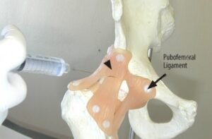 hippain2-transformed