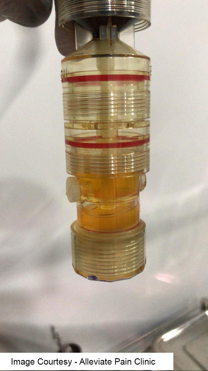 Buffy Coat Extraction 