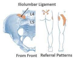 iliolumbar ligament