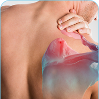 side frozen shoulder3